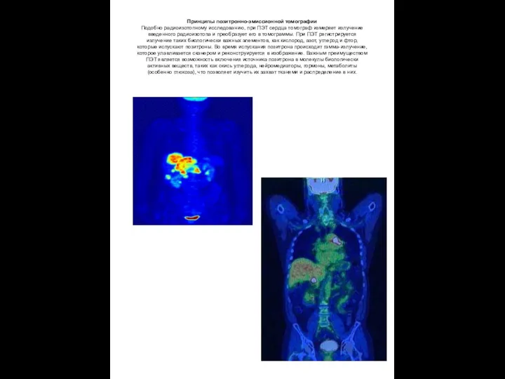 Принципы позитронно-эмиссионной томографии Подобно радиоизотопному исследованию, при ПЭТ сердца томограф измеряет