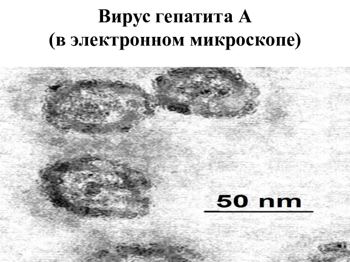 Вирус гепатита А (в электронном микроскопе)