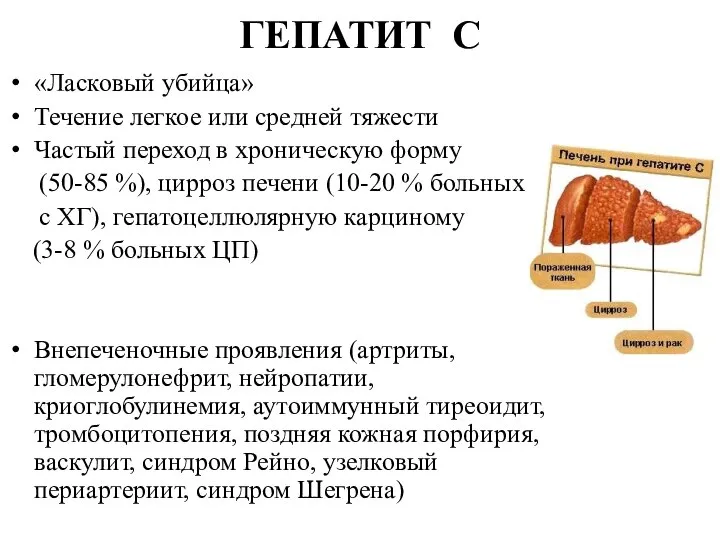 ГЕПАТИТ С «Ласковый убийца» Течение легкое или средней тяжести Частый переход