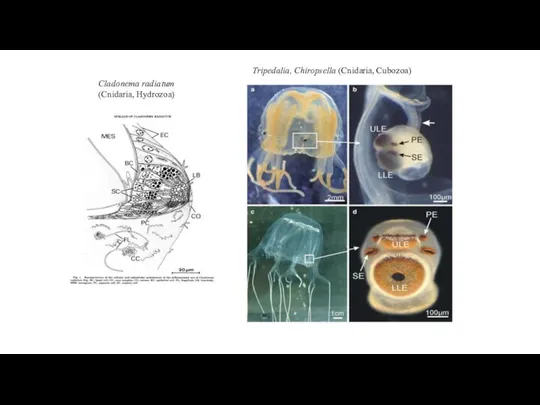 Cladonema radiatum (Cnidaria, Hydrozoa) Tripedalia, Chiropsella (Cnidaria, Cubozoa)