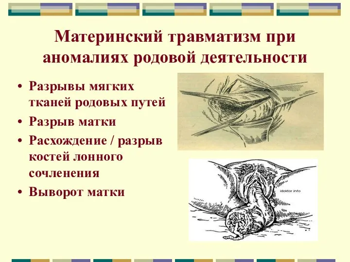 Материнский травматизм при аномалиях родовой деятельности Разрывы мягких тканей родовых путей