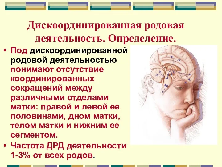 Дискоординированная родовая деятельность. Определение. Под дискоординированной родовой деятельностью понимают отсутствие координированных