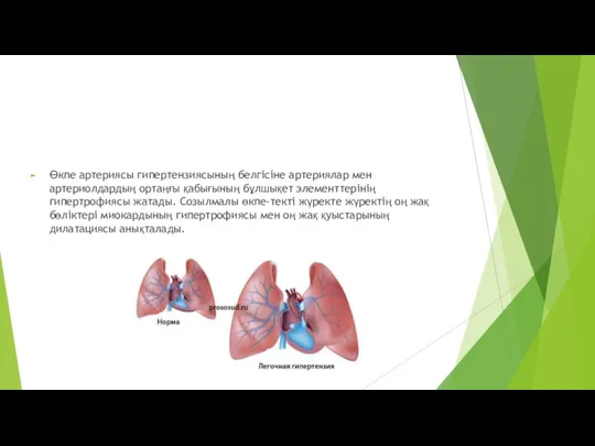 Өкпе артериясы гипертензиясының белгісіне артериялар мен артериолдардың ортаңғы қабығының бұлшықет элементтерінің