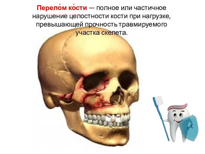 Перело́м ко́сти — полное или частичное нарушение целостности кости при нагрузке, превышающей прочность травмируемого участка скелета.