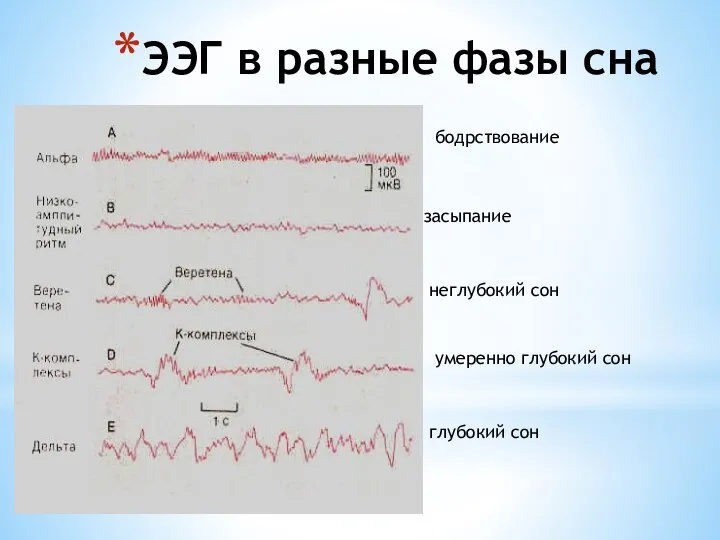 ЭЭГ в разные фазы сна бодрствование засыпание неглубокий сон умеренно глубокий сон глубокий сон