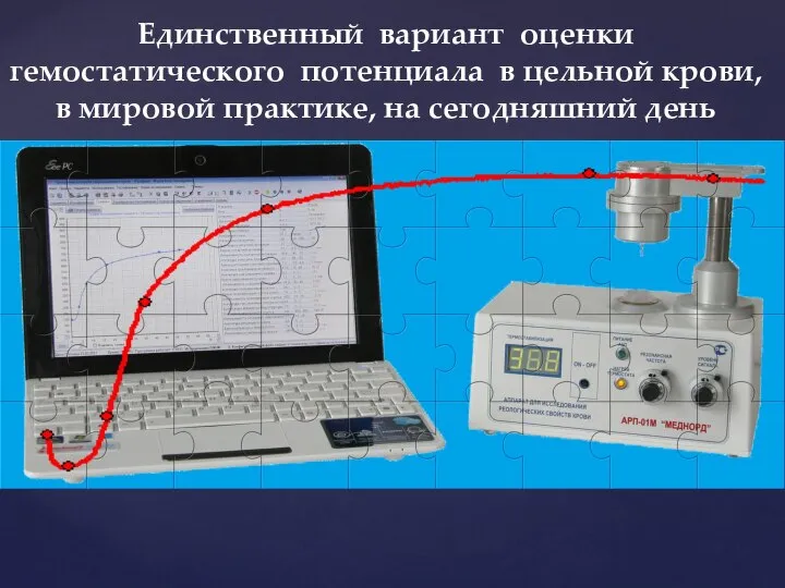 Единственный вариант оценки гемостатического потенциала в цельной крови, в мировой практике, на сегодняшний день