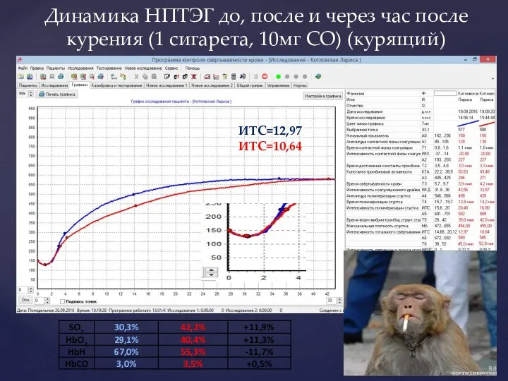 Динамика НПТЭГ до, после и через час после курения (1 сигарета, 10мг СО) (курящий) ИТС=12,97 ИТС=10,64