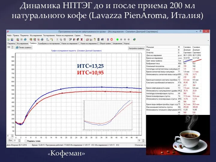 Динамика НПТЭГ до и после приема 200 мл натурального кофе (Lavazza PienAroma, Италия) «Кофеман» ИТС=13,25 ИТС=10,95