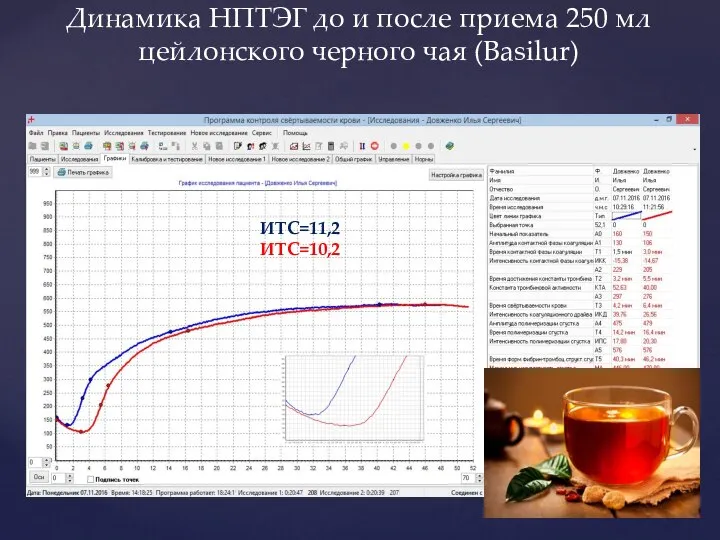 Динамика НПТЭГ до и после приема 250 мл цейлонского черного чая (Basilur) ИТС=11,2 ИТС=10,2