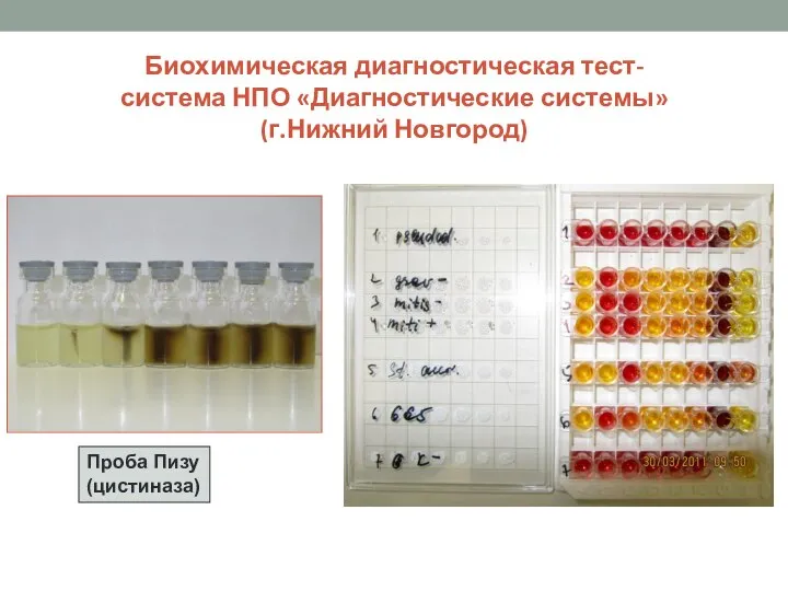 Биохимическая диагностическая тест-система НПО «Диагностические системы» (г.Нижний Новгород) Проба Пизу (цистиназа)