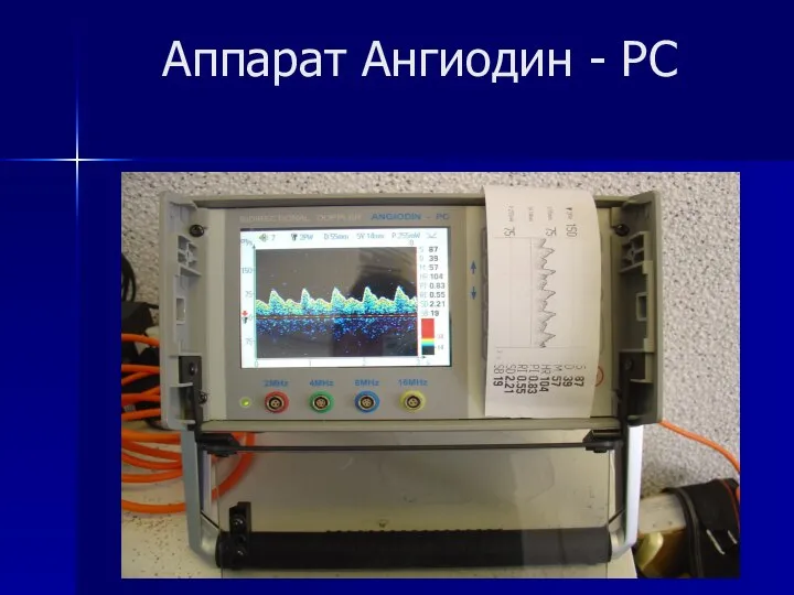 Аппарат Ангиодин - РС