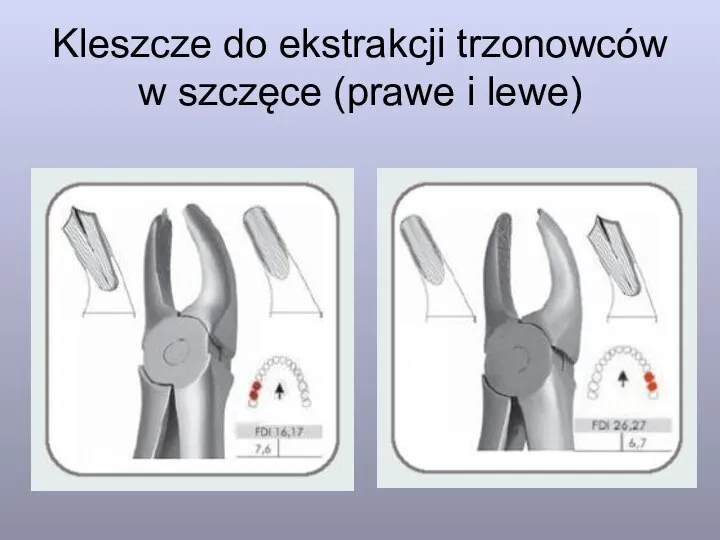 Kleszcze do ekstrakcji trzonowców w szczęce (prawe i lewe)