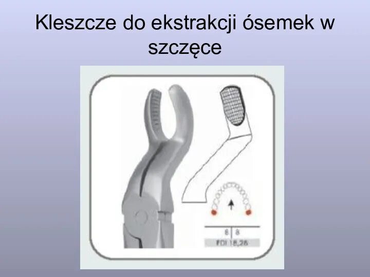 Kleszcze do ekstrakcji ósemek w szczęce