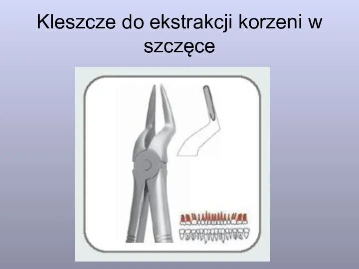 Kleszcze do ekstrakcji korzeni w szczęce