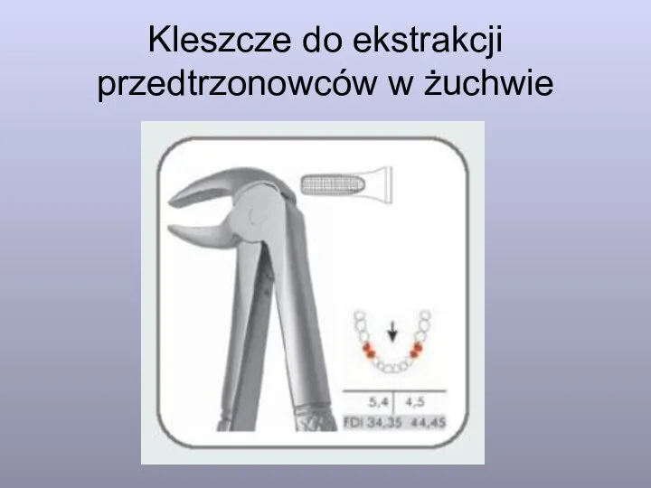 Kleszcze do ekstrakcji przedtrzonowców w żuchwie