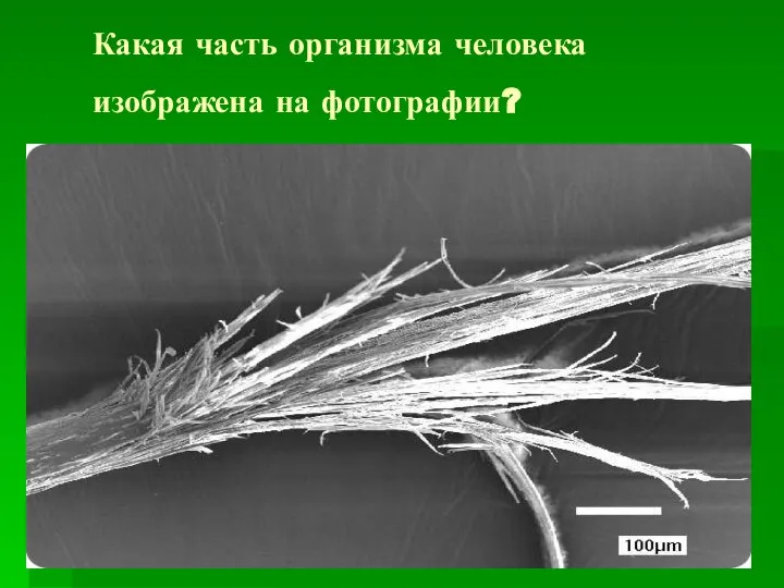 Какая часть организма человека изображена на фотографии?