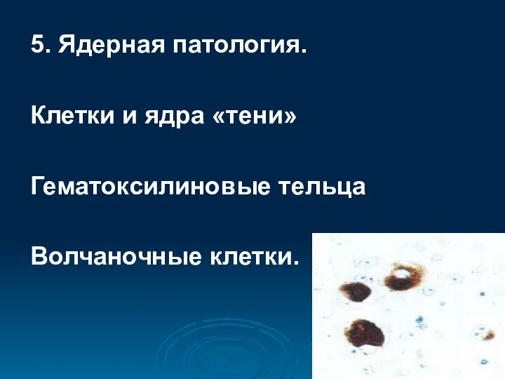 5. Ядерная патология. Клетки и ядра «тени» Гематоксилиновые тельца Волчаночные клетки.