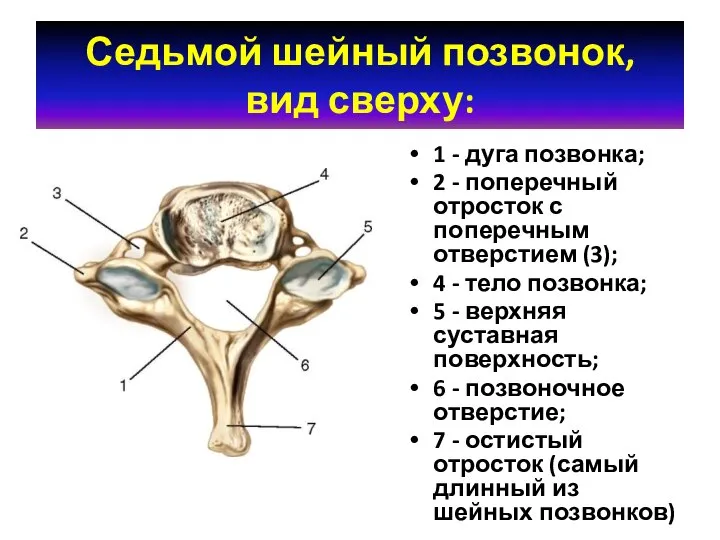 Седьмой шейный позвонок, вид сверху: 1 - дуга позвонка; 2 -