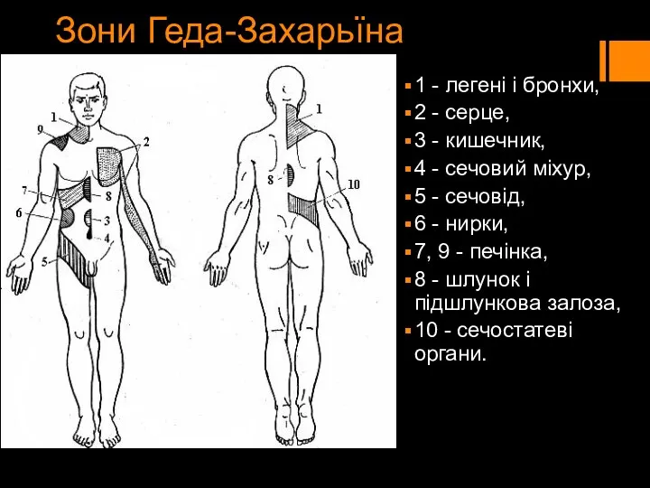 Зони Геда-Захарьїна 1 - легені і бронхи, 2 - серце, 3