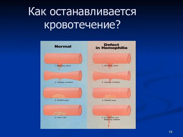 Как останавливается кровотечение?