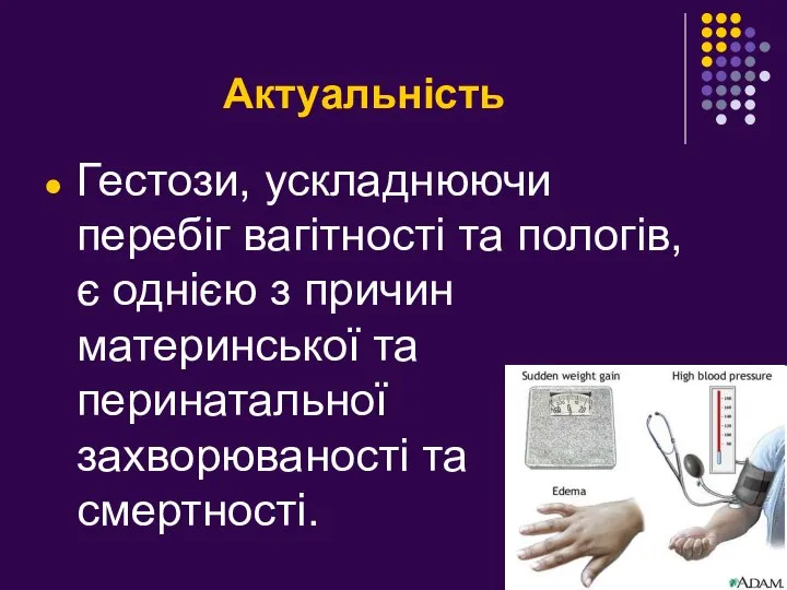 Актуальність Гестози, ускладнюючи перебіг вагітності та пологів, є однією з причин