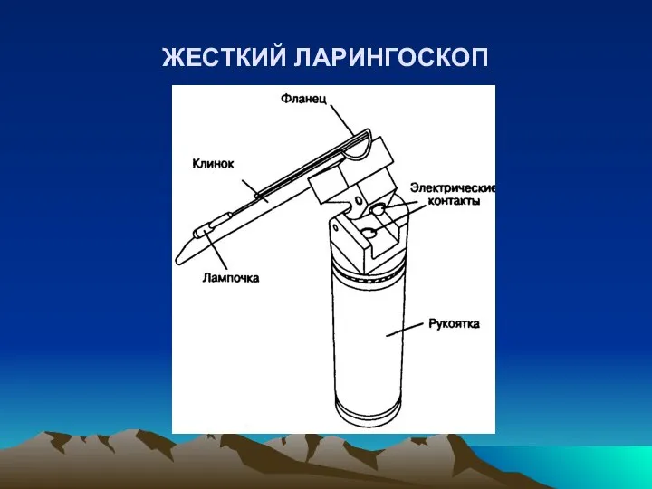 ЖЕСТКИЙ ЛАРИНГОСКОП