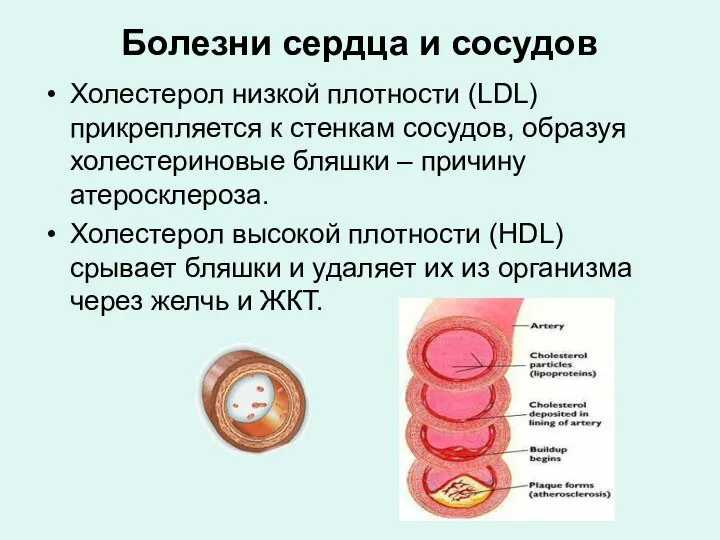 Болезни сердца и сосудов Холестерол низкой плотности (LDL) прикрепляется к стенкам