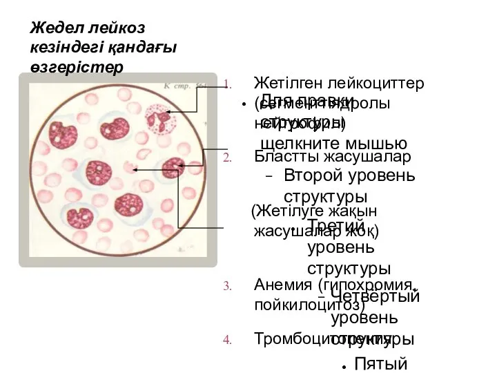 Жетілген лейкоциттер (сегменттіядролы нейтрофил) Бластты жасушалар (Жетілуге жақын жасушалар жоқ) Анемия