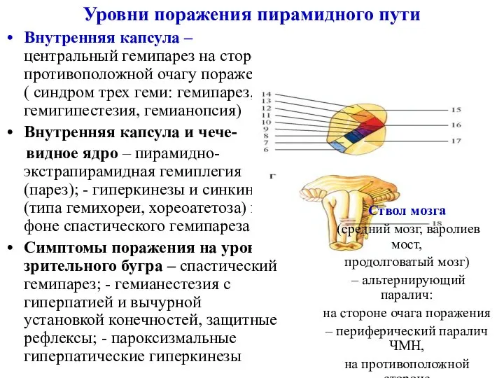 Уровни поражения пирамидного пути Внутренняя капсула – центральный гемипарез на стороне