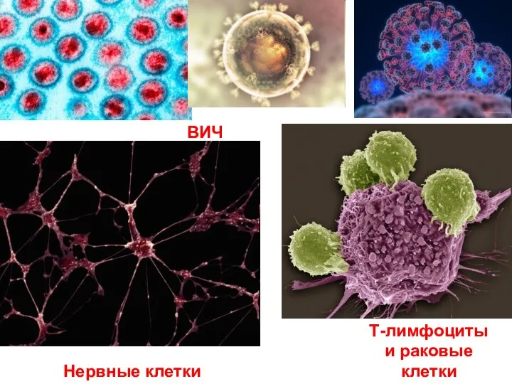 ВИЧ Т-лимфоциты и раковые клетки Нервные клетки