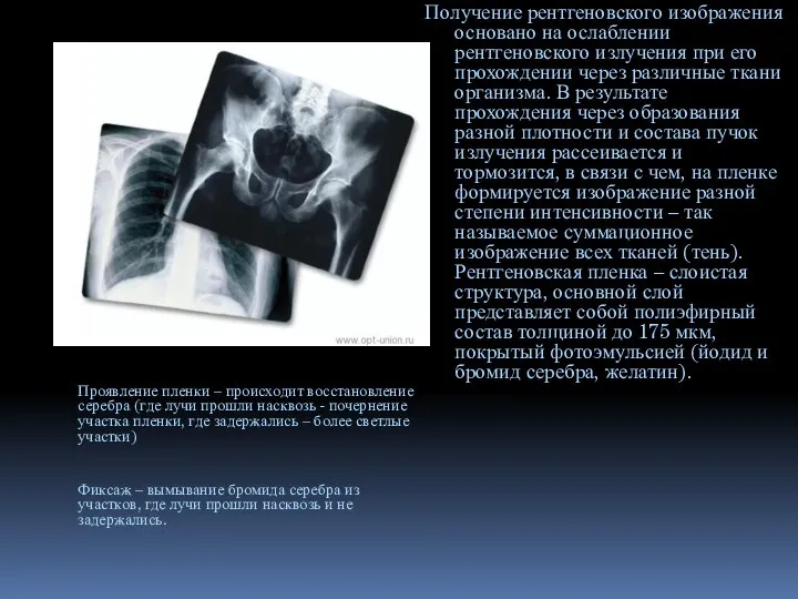 Получение рентгеновского изображения основано на ослаблении рентгеновского излучения при его прохождении