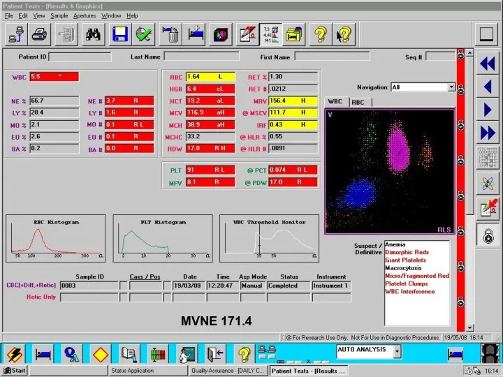 MVNE 171.4