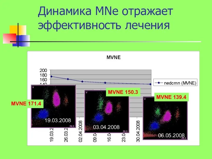 19.03.2008 03.04.2008 06.05.2008 MVNE 171.4 MVNE 150.3 MVNE 139.4 Динамика MNe отражает эффективность лечения