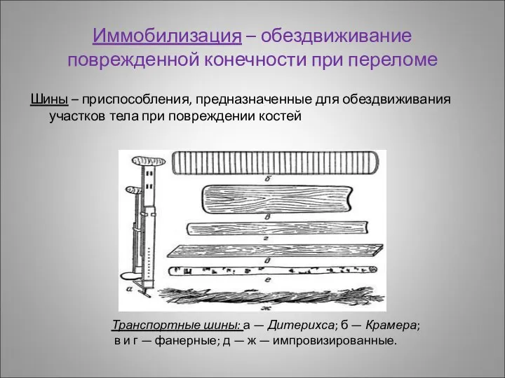 Иммобилизация – обездвиживание поврежденной конечности при переломе Шины – приспособления, предназначенные