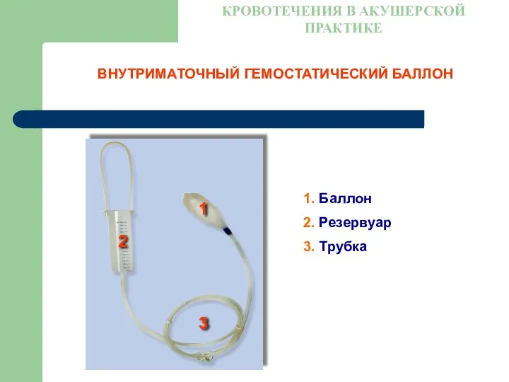 ВНУТРИМАТОЧНЫЙ ГЕМОСТАТИЧЕСКИЙ БАЛЛОН КРОВОТЕЧЕНИЯ В АКУШЕРСКОЙ ПРАКТИКЕ 1. Баллон 2. Резервуар 3. Трубка
