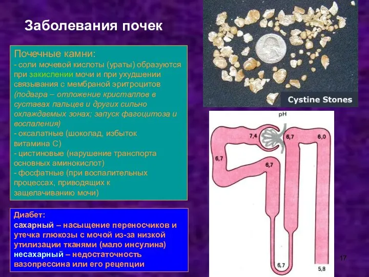 Почечные камни: - соли мочевой кислоты (ураты) образуются при закислении мочи