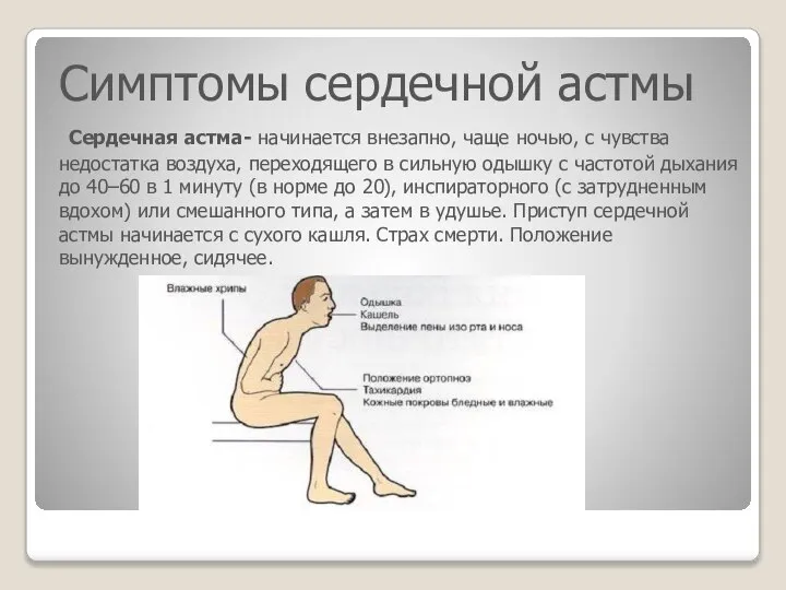 Симптомы сердечной астмы Сердечная астма- начинается внезапно, чаще ночью, с чувства