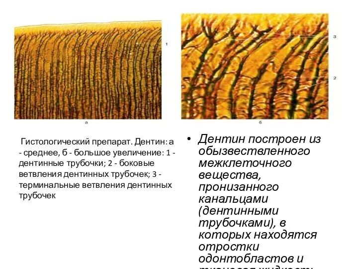 Дентин построен из обызвествленного межклеточного вещества, пронизанного канальцами (дентинными трубочками), в