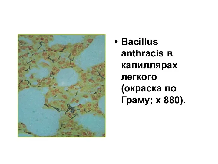 Bacillus anthracis в капиллярах легкого (окраска по Граму; x 880).