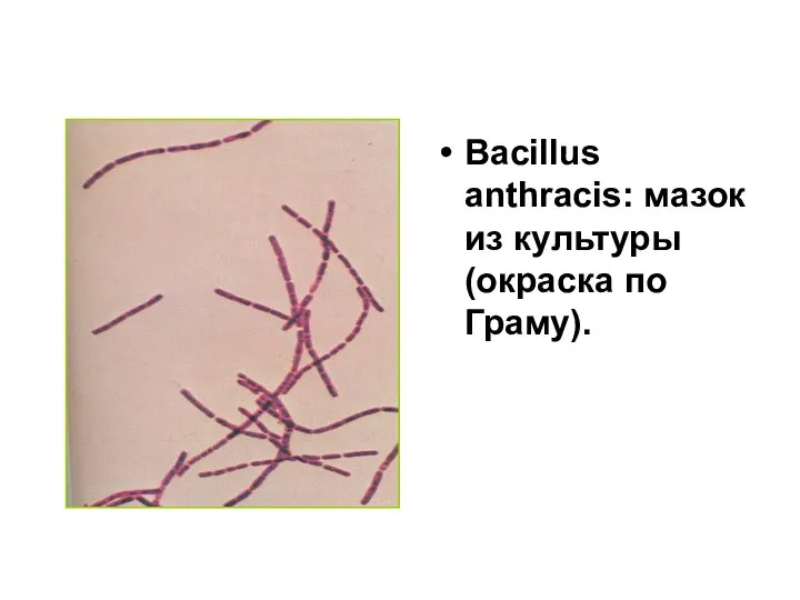 Bacillus anthracis: мазок из культуры (окраска по Граму).