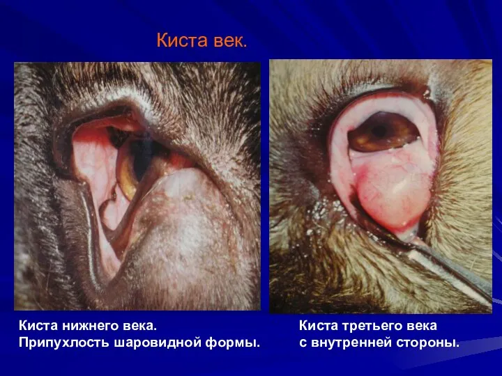 Киста век. Киста нижнего века. Припухлость шаровидной формы. Киста третьего века с внутренней стороны.