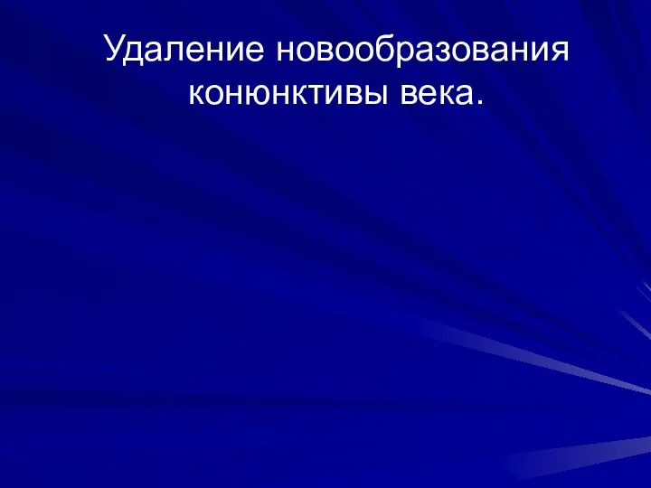 Удаление новообразования конюнктивы века.