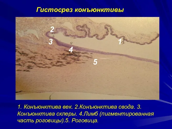 2 3 4 1 Гистосрез конъюнктивы 1. Конъюнктива век. 2.Конъюнктива свода.