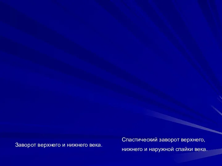 Заворот верхнего и нижнего века. Спастический заворот верхнего, нижнего и наружной спайки века.