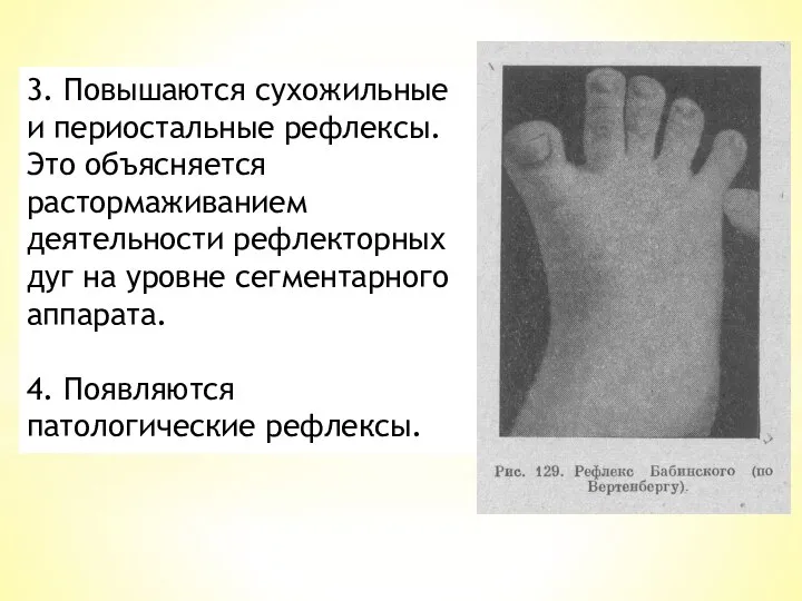 3. Повышаются сухожильные и периостальные рефлексы. Это объясня­ется растормаживанием деятельности рефлекторных