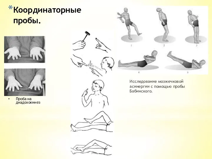 Координаторные пробы. Исследование мозжечковой асинергии с помощью пробы Бабинского. Проба на диадохокинез