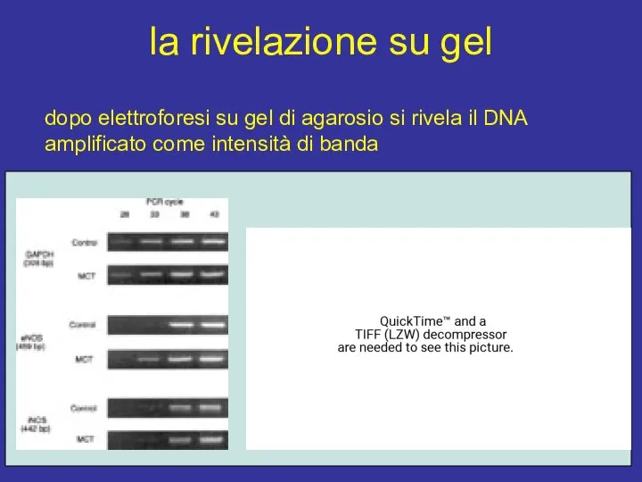 la rivelazione su gel dopo elettroforesi su gel di agarosio si