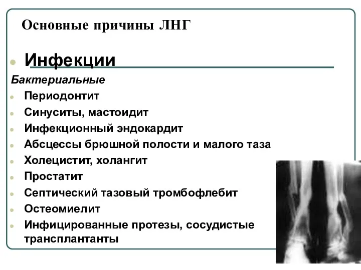 Основные причины ЛНГ Инфекции Бактериальные Периодонтит Синуситы, мастоидит Инфекционный эндокардит Абсцессы