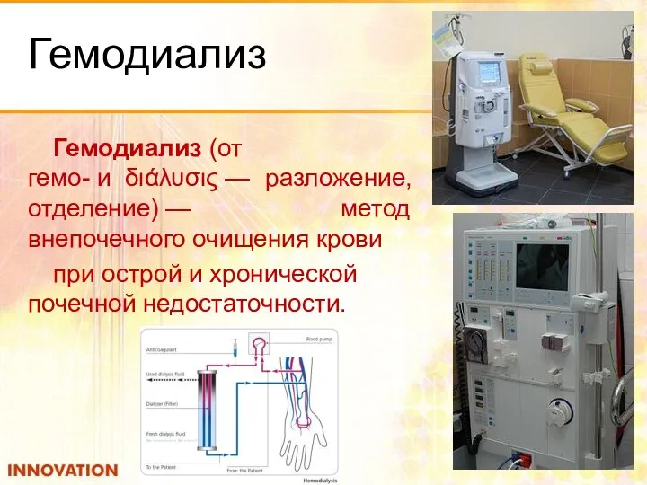 Гемодиализ Гемодиализ (от гемо- и διάλυσις — разложение, отделение) — метод