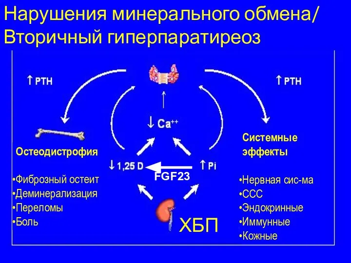 Нарушения минерального обмена/ Вторичный гиперпаратиреоз Нарушения минерального обмена/ Вторичный гиперпаратиреоз Остеодистрофия